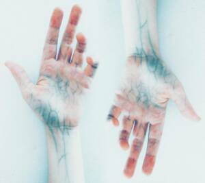 Calroy Health Sciences